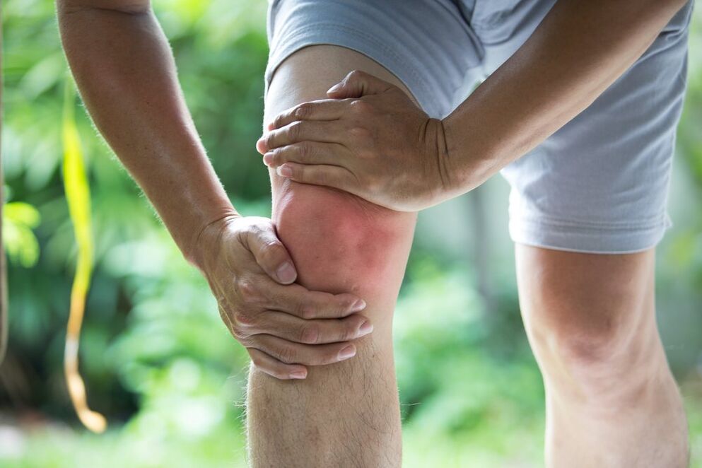 Артроза на коляното